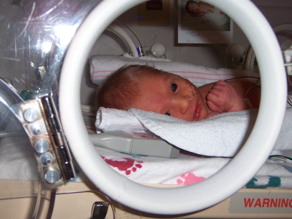 Jack- 3 Days Old